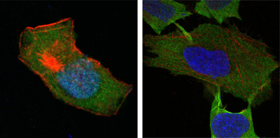 Confocal immunofluorescence analysis of HepG2 (left) and L-02 (right) cells using GSTP1 mouse mAb (green). Red: Actin filaments have been labeled with DY-554 phalloidin. Blue: DRAQ5 fluorescent DNA dye.