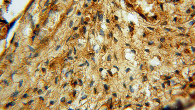 Immunohistochemical of paraffin-embedded human placenta using Catalog No:111912(KARS antibody) at dilution of 1:100 (under 40x lens)