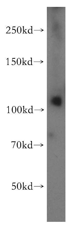 K-562 cells were subjected to SDS PAGE followed by western blot with Catalog No:113879(PI4KB antibody) at dilution of 1:300