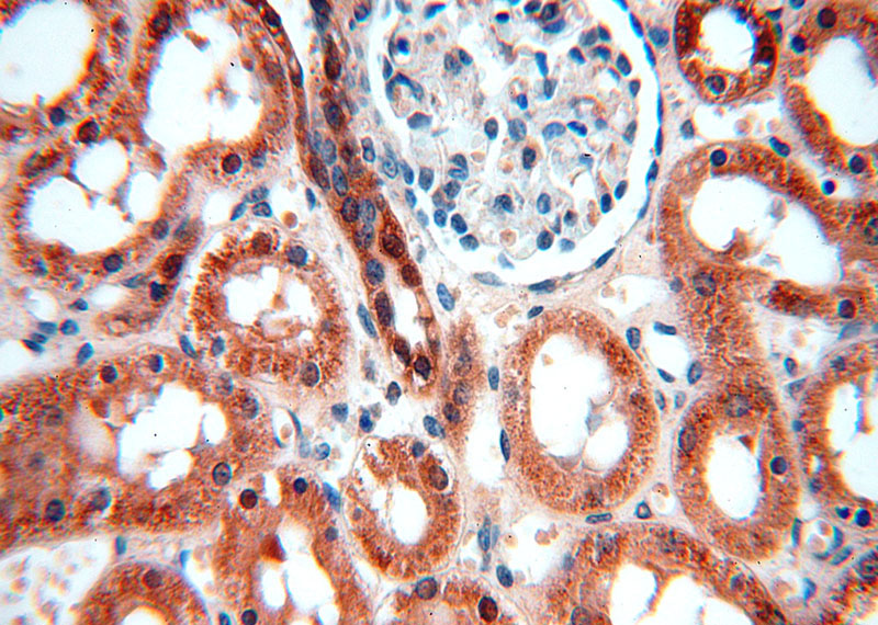 Immunohistochemical of paraffin-embedded human kidney using Catalog No:109221(CHD9 antibody) at dilution of 1:100 (under 40x lens)