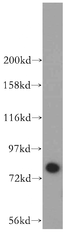 HEK-293 cells were subjected to SDS PAGE followed by western blot with Catalog No:111432(HLCS antibody) at dilution of 1:700