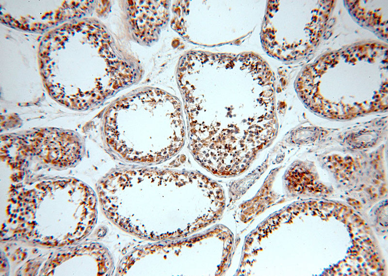 Immunohistochemical of paraffin-embedded human testis using Catalog No:112186(LDHC antibody) at dilution of 1:100 (under 10x lens)