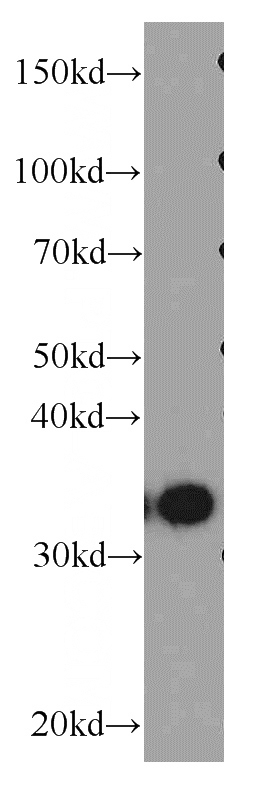 Jurkat cells were subjected to SDS PAGE followed by western blot with Catalog No:111500(HNRNPA1 antibody) at dilution of 1:400