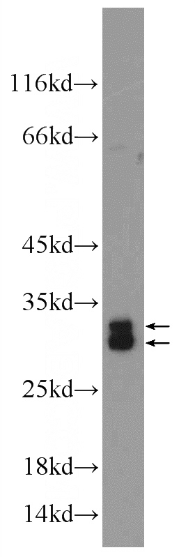 MCF-7 cells were subjected to SDS PAGE followed by western blot with Catalog No:115662(SRA1 Antibody) at dilution of 1:1000