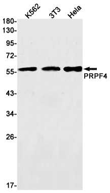 Western blot detection of PRPF4 in K562,3T3,Hela cell lysates using PRPF4 Rabbit mAb(1:1000 diluted).Predicted band size:59kDa.Observed band size:59kDa.