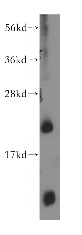 HepG2 cells were subjected to SDS PAGE followed by western blot with Catalog No:115002(SCML1 antibody) at dilution of 1:400
