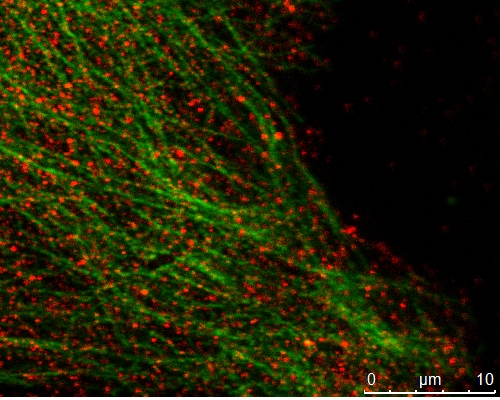 Mouse keratinocyte showing MAPRE2 (#Catalog No:112444, 1:100 dilution, with Alexa 594 labelled 2nd Ab) in red and alpha-tubulin (#Catalog No:, 1:100 dilution, with Alexa 488 labelled 2nd Ab) in green.