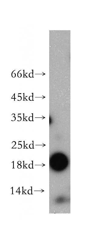 mouse heart tissue were subjected to SDS PAGE followed by western blot with Catalog No:112969(MYL7 antibody) at dilution of 1:800