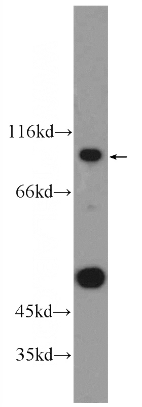 HEK-293 cells were subjected to SDS PAGE followed by western blot with Catalog No:108083(ANKRD6 Antibody) at dilution of 1:300