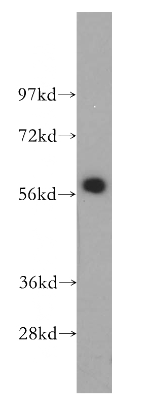 HepG2 cells were subjected to SDS PAGE followed by western blot with Catalog No:109550(CREB5 antibody) at dilution of 1:500