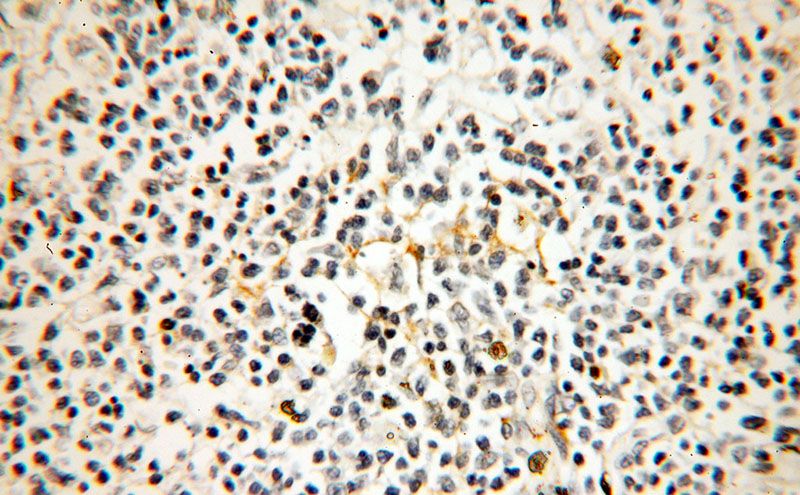Immunohistochemical of paraffin-embedded human spleen using Catalog No:109141(CD82 antibody) at dilution of 1:50 (under 40x lens)