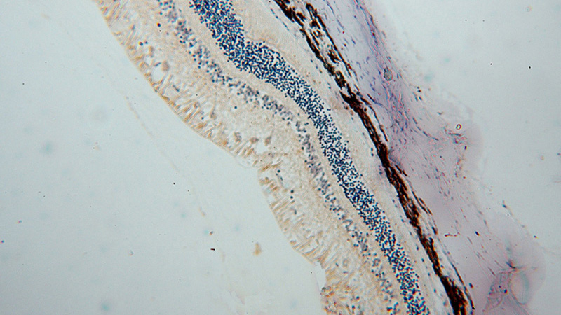 Immunohistochemical of paraffin-embedded human eye using Catalog No:107958(ALDH1A1 antibody) at dilution of 1:100 (under 10x lens)