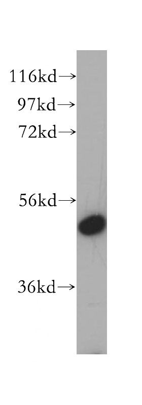 Y79 cells were subjected to SDS PAGE followed by western blot with Catalog No:116792(VPS4B antibody) at dilution of 1:500
