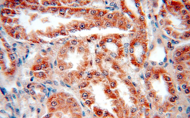 Immunohistochemical of paraffin-embedded human kidney using Catalog No:113627(PDK4 antibody) at dilution of 1:50 (under 40x lens)