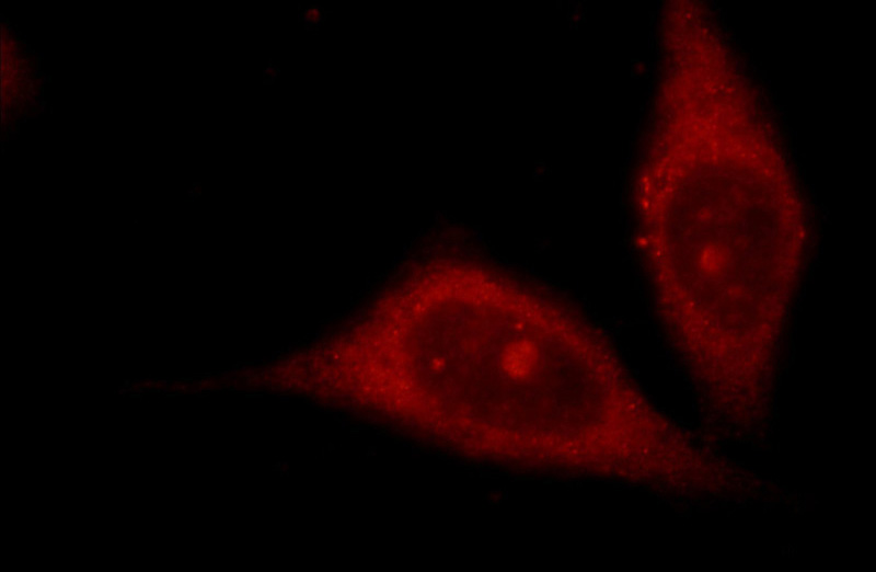 Immunofluorescent analysis of HeLa cells using Catalog No:108177(ARHGAP4 Antibody) at dilution of 1:25 and Rhodamine-Goat anti-Rabbit IgG
