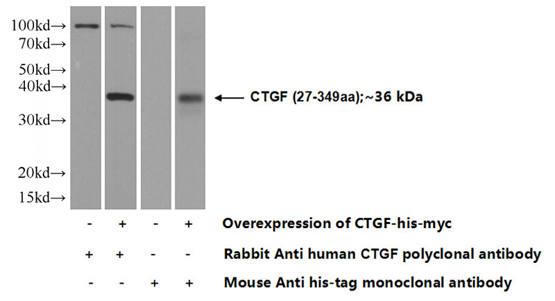 Transfected HEK-293 cells were subjected to SDS PAGE followed by western blot with Catalog No:109723(CTGF Antibody) at dilution of 1:1000