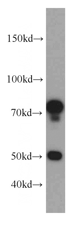 mouse lung tissue were subjected to SDS PAGE followed by western blot with Catalog No:115188(SH3BP1 antibody) at dilution of 1:500