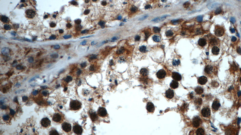 Immunohistochemistry of paraffin-embedded human testis tissue slide using Catalog No:115973(TADA1L Antibody) at dilution of 1:50 (under 40x lens)