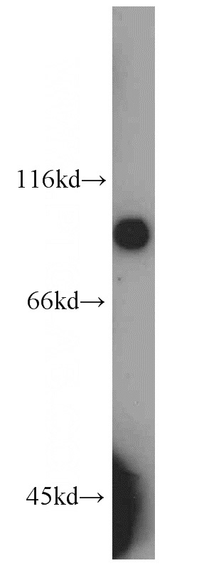mouse kidney tissue were subjected to SDS PAGE followed by western blot with Catalog No:108730(C4orf14 antibody) at dilution of 1:1500