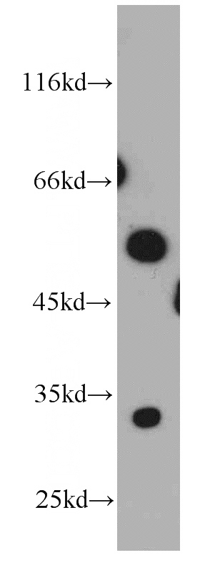 mouse kidney tissue were subjected to SDS PAGE followed by western blot with Catalog No:113273(NRBP2 antibody) at dilution of 1:500