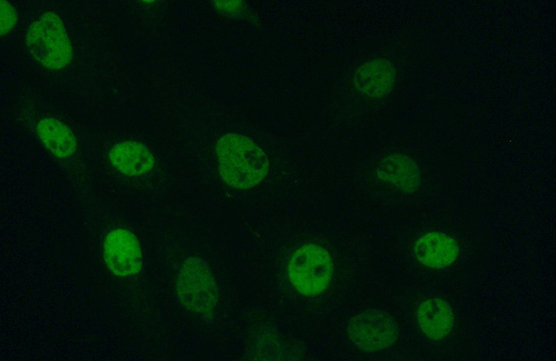 Immunofluorescent analysis of (10% Formaldehyde) fixed A431 cells using Catalog No:113558(TP63 Antibody) at dilution of 1:50 and Alexa Fluor 488-congugated AffiniPure Goat Anti-Rabbit IgG(H+L)