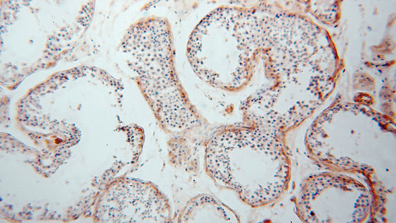 Immunohistochemical of paraffin-embedded human testis using Catalog No:111552(HSD3B2 antibody) at dilution of 1:100 (under 10x lens)