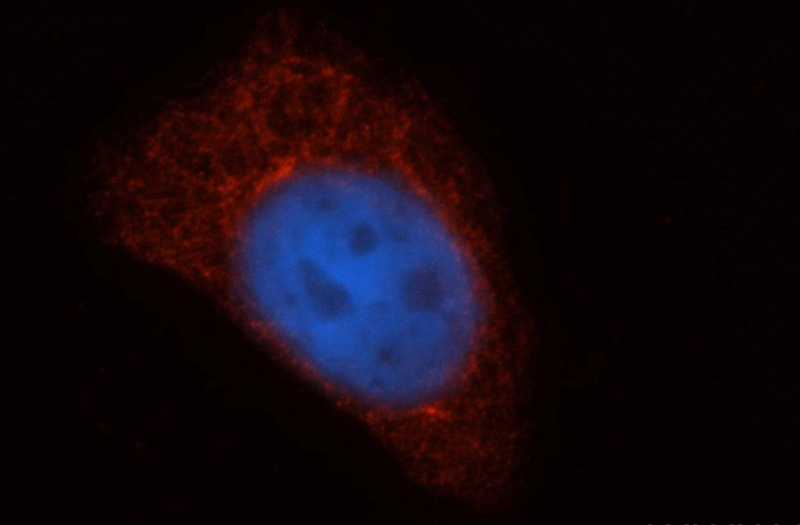 Immunofluorescent analysis of HepG2 cells, using TAP1 antibody Catalog No:115850 at 1:50 dilution and Rhodamine-labeled goat anti-rabbit IgG (red). Blue pseudocolor = DAPI (fluorescent DNA dye).