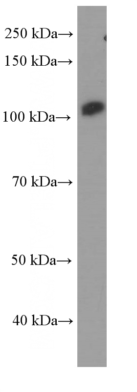 MCF-7 cells were subjected to SDS PAGE followed by western blot with (FAK Antibody) at dilution of 1:1000