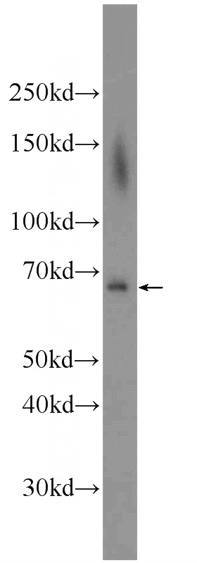 BxPC-3 cells were subjected to SDS PAGE followed by western blot with Catalog No:107768(ADAM8 Antibody) at dilution of 1:600