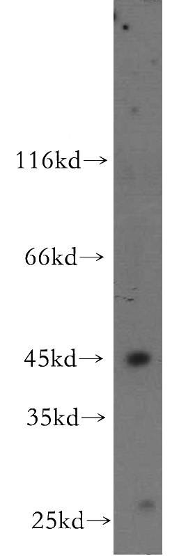 mouse lung tissue were subjected to SDS PAGE followed by western blot with Catalog No:117092(B3GNT5 antibody) at dilution of 1:500