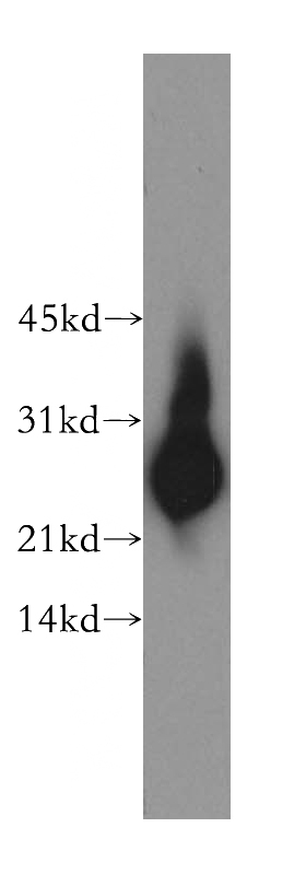 mouse testis tissue were subjected to SDS PAGE followed by western blot with Catalog No:115526(SPA17 antibody) at dilution of 1:400
