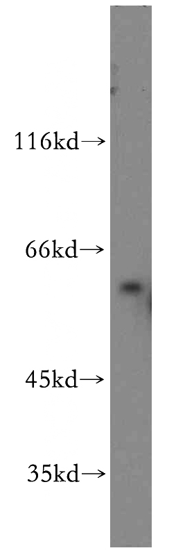 A431 cells were subjected to SDS PAGE followed by western blot with Catalog No:114859(RTKN antibody) at dilution of 1:300
