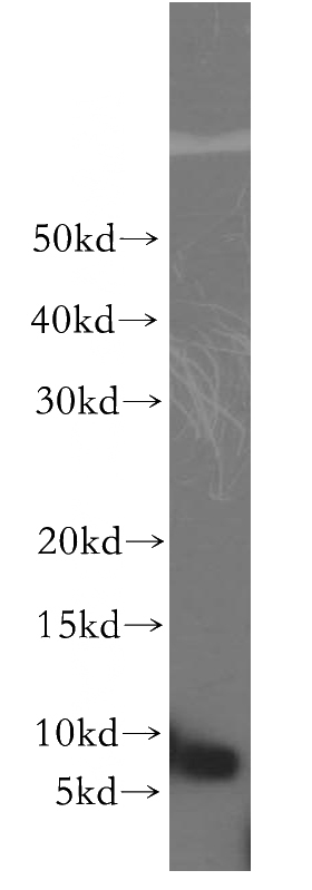 HepG2 cells were subjected to SDS PAGE followed by western blot with Catalog No:115128(SERF2 antibody) at dilution of 1:500