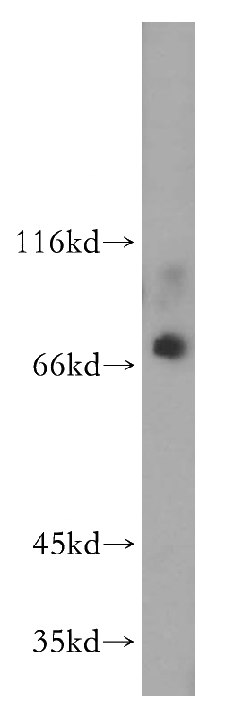 HEK-293 cells were subjected to SDS PAGE followed by western blot with Catalog No:117043(ZFP64 antibody) at dilution of 1:400