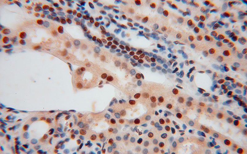 Immunohistochemical of paraffin-embedded human kidney using Catalog No:107258(HDGF antibody) at dilution of 1:50 (under 40x lens)