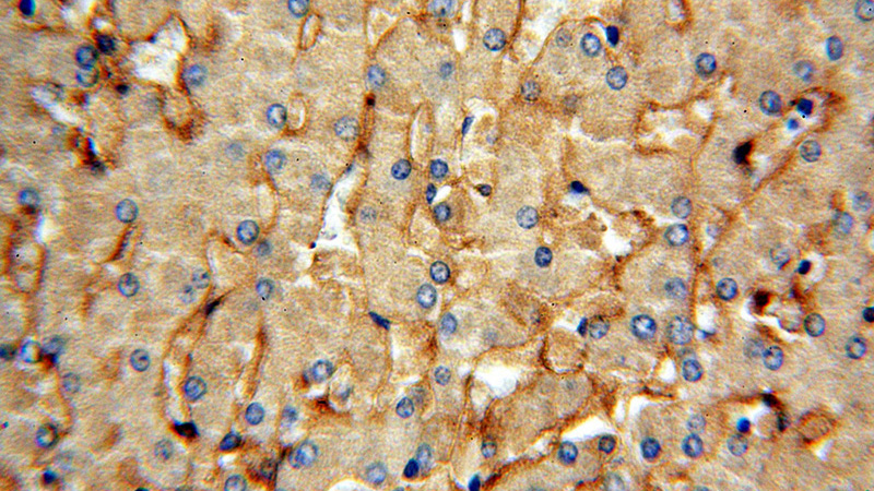 Immunohistochemical of paraffin-embedded human liver using Catalog No:109006(MRC1 antibody) at dilution of 1:100 (under 40x lens)