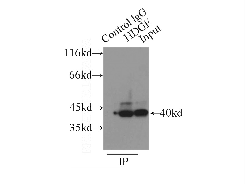 IP Result of anti-HDGF (IP:Catalog No:111386, 3ug; Detection:Catalog No:111386 1:1000) with HepG2 cells lysate 3000ug.