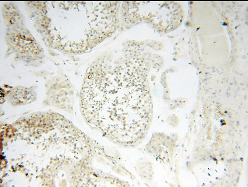 Immunohistochemical of paraffin-embedded human testis using Catalog No:108856(CARD6 antibody) at dilution of 1:100 (under 10x lens)