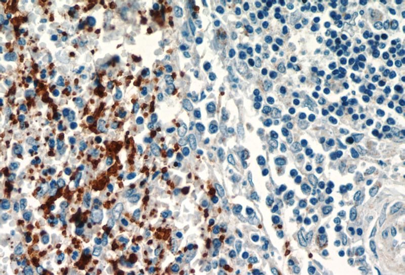 Immunohistochemistry of paraffin-embedded human spleen slide using Catalog No:109121(ITGA2B Antibody) at dilution of 1:50