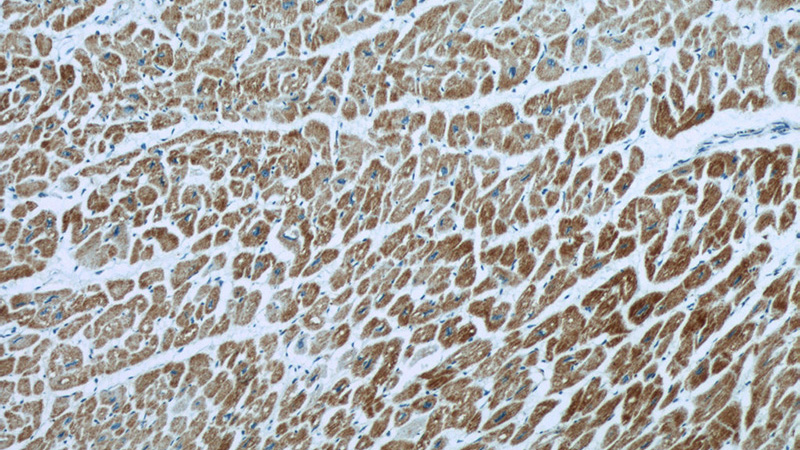Immunohistochemical of paraffin-embedded human heart using Catalog No:116635(UQCRC1 antibody) at dilution of 1:100 (under 10x lens)