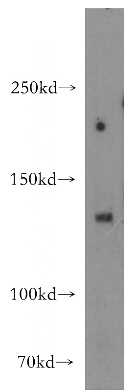 MCF7 cells were subjected to SDS PAGE followed by western blot with Catalog No:111381(HDAC6-speciifc antibody) at dilution of 1:200