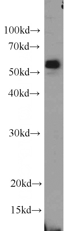 PC-3 cells were subjected to SDS PAGE followed by western blot with Catalog No:115546(SPAST antibody) at dilution of 1:1000