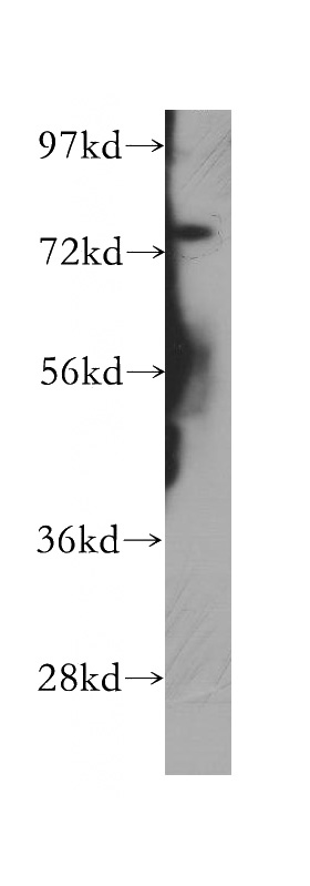HEK-293 cells were subjected to SDS PAGE followed by western blot with Catalog No:113813(PHF21A antibody) at dilution of 1:500