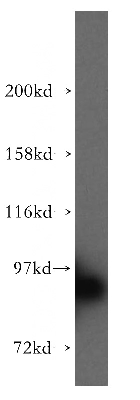 K-562 cells were subjected to SDS PAGE followed by western blot with Catalog No:115693(STAT5B antibody) at dilution of 1:1500