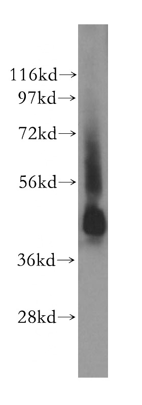 PC-3 cells were subjected to SDS PAGE followed by western blot with Catalog No:115636(STAC antibody) at dilution of 1:500