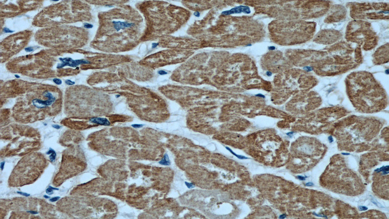 Immunohistochemical of paraffin-embedded human heart using Catalog No:107864(ACTC1 antibody) at dilution of 1:100 (under 40x lens)