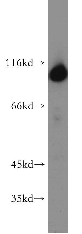 human brain tissue were subjected to SDS PAGE followed by western blot with Catalog No:111306(HK1 antibody) at dilution of 1:500