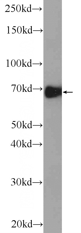 HeLa cells were subjected to SDS PAGE followed by western blot with Catalog No:108160(ARNTL Antibody) at dilution of 1:600