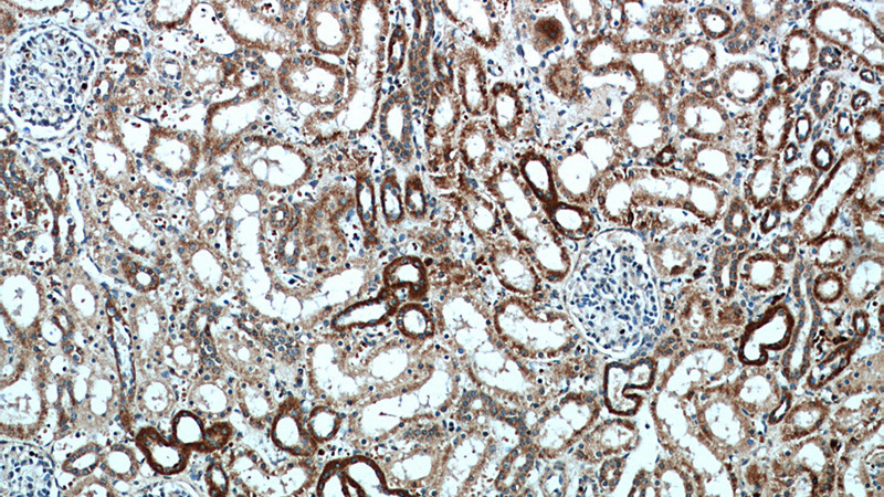 Immunohistochemical of paraffin-embedded human kidney using Catalog No:109350(CLEC18A antibody) at dilution of 1:50 (under 10x lens)