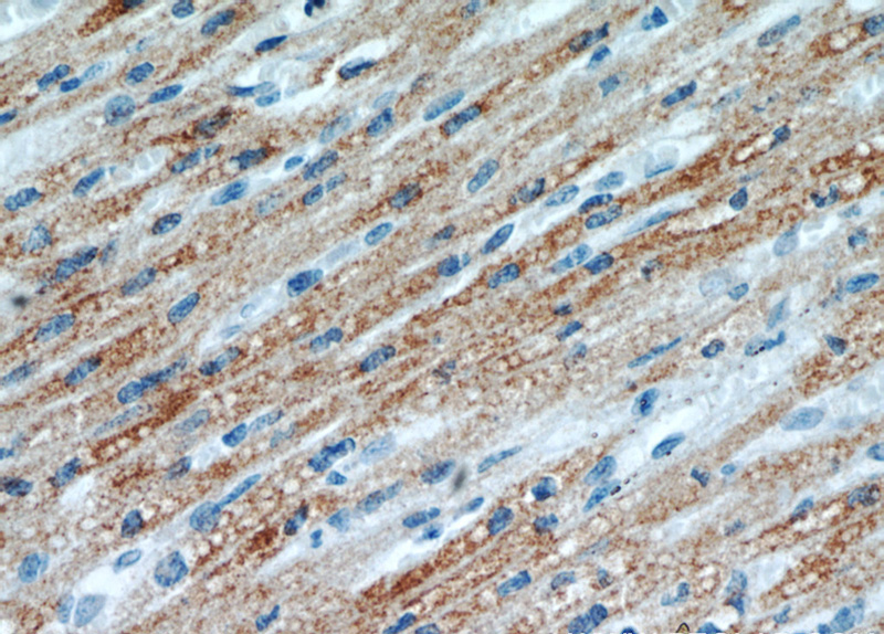 Immunohistochemical of paraffin-embedded human heart using Catalog No:112106(KLHL35 antibody) at dilution of 1:100 (under 40x lens)
